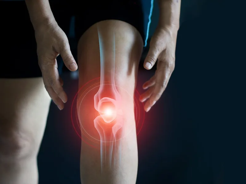 Camel City Chiropractic treating arthritis in Winston-Salem
