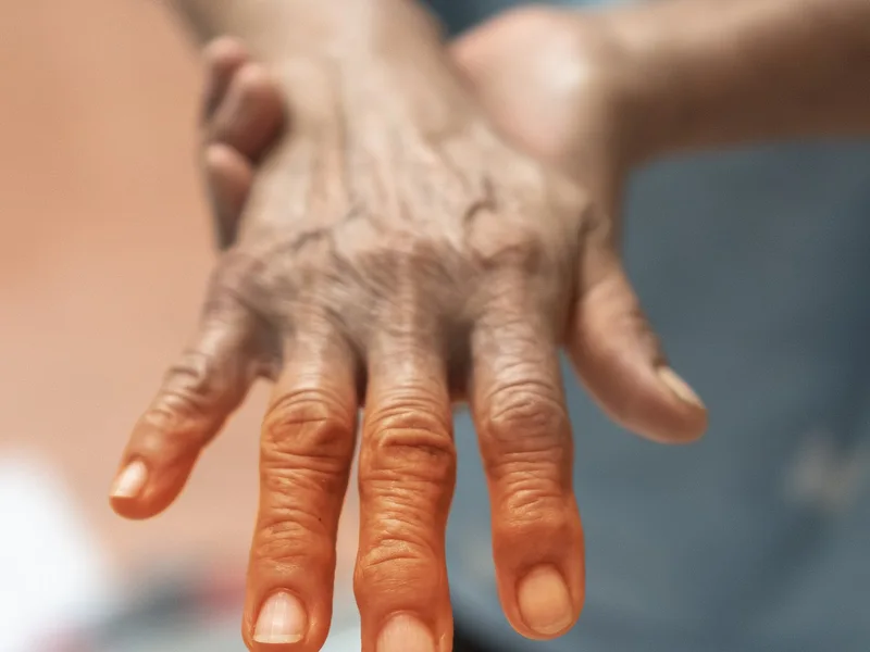 How Camel City Chiropractic treats neuropathy in Winston-Salem