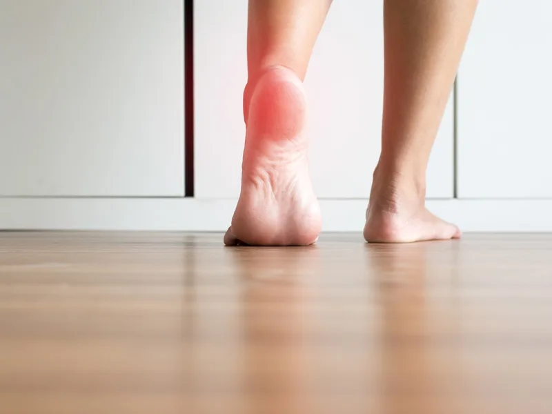 How Camel City Chiropractic treats plantar fasciitis in Winston-Salem